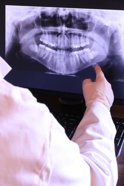 Best Emergency Dental Care for Broken or Chipped Teeth in Millis Clicquot, MA